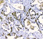 CDA Antibody in Immunohistochemistry (Paraffin) (IHC (P))