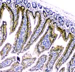 CDA Antibody in Immunohistochemistry (Paraffin) (IHC (P))