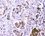 CDA Antibody in Immunohistochemistry (Paraffin) (IHC (P))