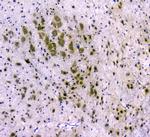 CDA Antibody in Immunohistochemistry (Paraffin) (IHC (P))