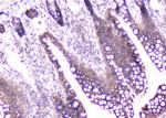 CDA Antibody in Immunohistochemistry (Paraffin) (IHC (P))