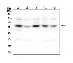 CDK8 Antibody in Western Blot (WB)