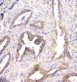 CHM Antibody in Immunohistochemistry (Paraffin) (IHC (P))