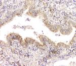 CHM Antibody in Immunohistochemistry (Paraffin) (IHC (P))