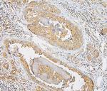 IQGAP1 Antibody in Immunohistochemistry (Paraffin) (IHC (P))