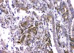 RMI2 Antibody in Immunohistochemistry (Paraffin) (IHC (P))