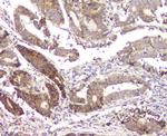 RMI2 Antibody in Immunohistochemistry (Paraffin) (IHC (P))