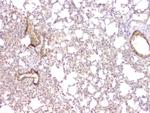 TIM17 Antibody in Immunohistochemistry (Paraffin) (IHC (P))