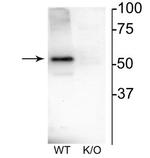 CHRNB4 Antibody in Western Blot (WB)