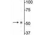 GABRB1 Antibody in Western Blot (WB)