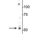 GABRB3 Antibody in Western Blot (WB)