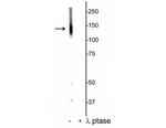 Phospho-KCC2 (Thr1007) Antibody in Western Blot (WB)