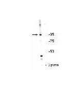 Phospho-INSR (Thr1160) Antibody in Western Blot (WB)