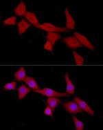 CAB39 Antibody in Immunocytochemistry (ICC/IF)