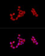 CAB39 Antibody in Immunocytochemistry (ICC/IF)