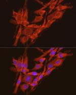 CK2 alpha-2 Antibody in Immunocytochemistry (ICC/IF)