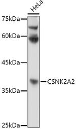 CK2 alpha-2 Antibody in Western Blot (WB)