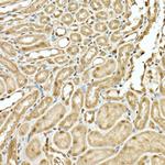 KIAA1429 Antibody in Immunohistochemistry (Paraffin) (IHC (P))