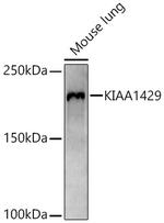 KIAA1429 Antibody in Western Blot (WB)