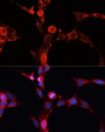 ASM Antibody in Immunocytochemistry (ICC/IF)