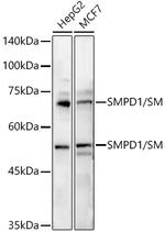 ASM Antibody in Western Blot (WB)