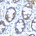 FUT4 Antibody in Immunohistochemistry (Paraffin) (IHC (P))