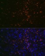 FUT4 Antibody in Immunohistochemistry (Paraffin) (IHC (P))