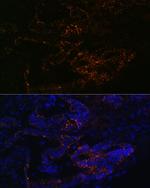 FUT4 Antibody in Immunohistochemistry (Paraffin) (IHC (P))