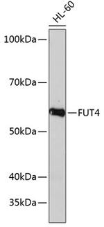 FUT4 Antibody in Western Blot (WB)