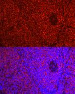 beta-1 Adrenergic Receptor Antibody in Immunohistochemistry (Paraffin) (IHC (P))