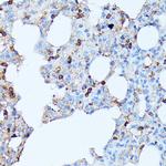 CXCR1 Antibody in Immunohistochemistry (Paraffin) (IHC (P))