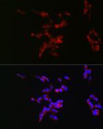 NEFM Antibody in Immunocytochemistry (ICC/IF)