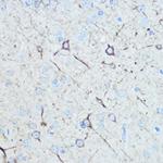 NEFM Antibody in Immunohistochemistry (Paraffin) (IHC (P))