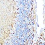 NEFM Antibody in Immunohistochemistry (Paraffin) (IHC (P))