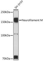 NEFM Antibody in Western Blot (WB)