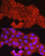 SCD Antibody in Immunocytochemistry (ICC/IF)