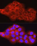 SCD Antibody in Immunocytochemistry (ICC/IF)