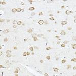 SCD Antibody in Immunohistochemistry (Paraffin) (IHC (P))