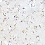 SCD Antibody in Immunohistochemistry (Paraffin) (IHC (P))