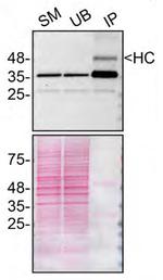 SCD Antibody in Immunoprecipitation (IP)