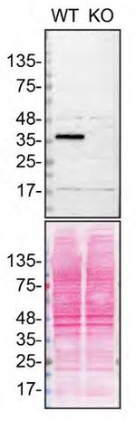 SCD Antibody in Western Blot (WB)