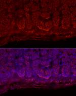 STAR Antibody in Immunocytochemistry (ICC/IF)