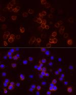 STAR Antibody in Immunocytochemistry (ICC/IF)