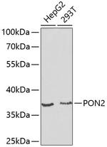 PON2 Antibody in Western Blot (WB)