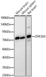 ZNF263 Antibody in Western Blot (WB)