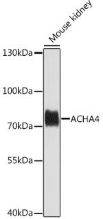 CHRNA4 Antibody in Western Blot (WB)