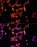 HPa1 Antibody in Immunocytochemistry (ICC/IF)