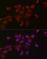 DNM1L Antibody in Immunocytochemistry (ICC/IF)