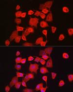 NOTCH1 Antibody in Immunocytochemistry (ICC/IF)