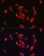 NOTCH1 Antibody in Immunocytochemistry (ICC/IF)